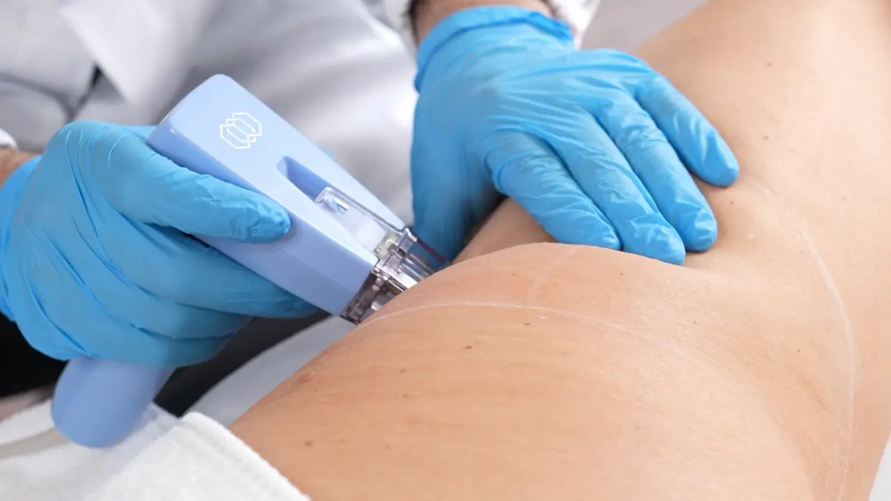 MORPHEUS INMODE Medical Salus ROma