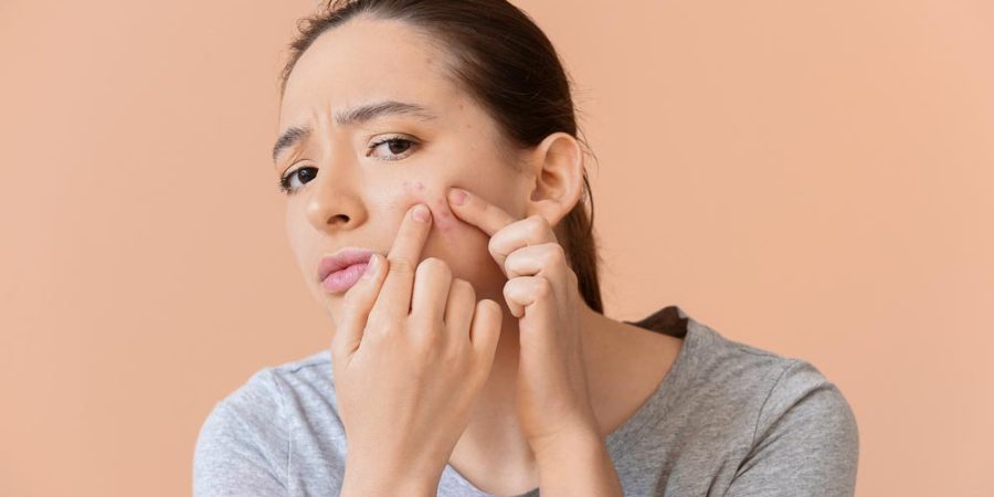 Luce pulsata: il rimedio per combattere l'acne